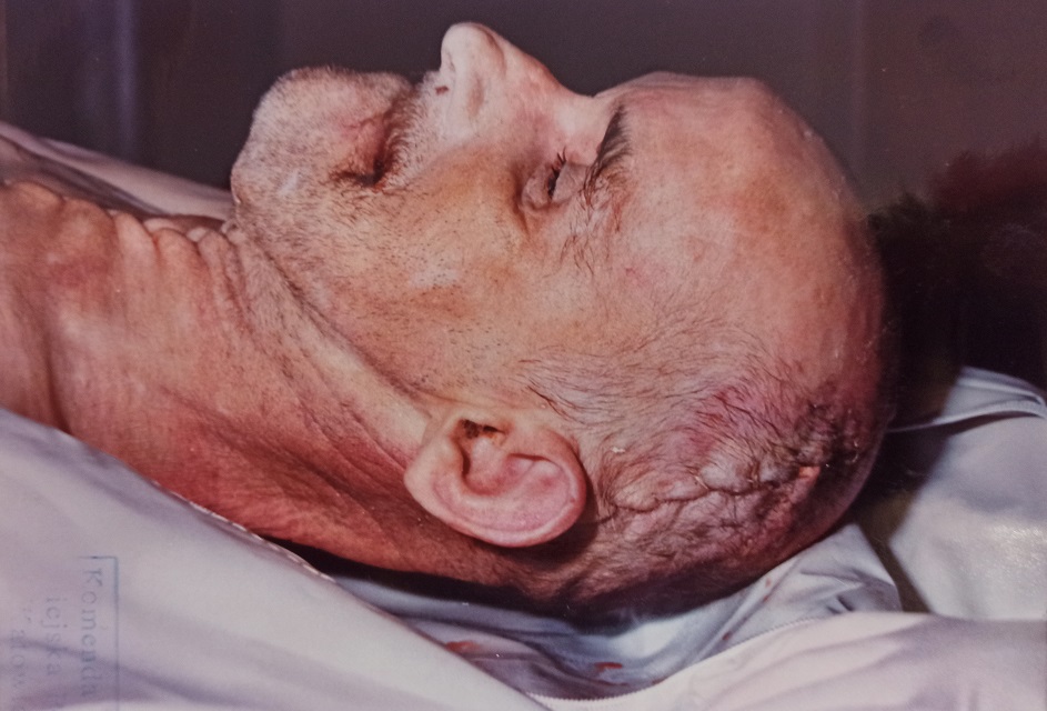 zdjęcie kolorowe: głowa zmarłego łysego mężczyzny z wąsem, profil lewy 
