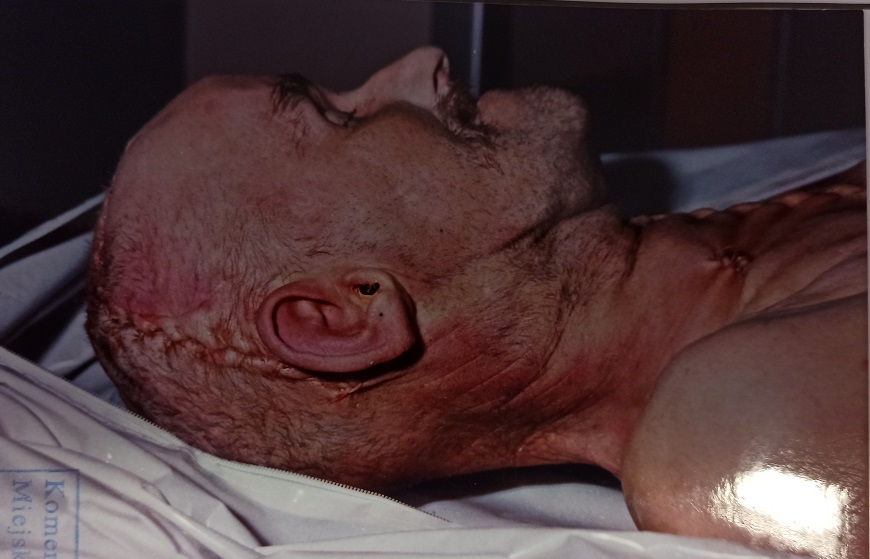 zdjęcie kolorowe: głowa zmarłego łysego mężczyzny z wąsem, profil prawy