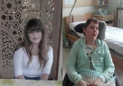 zdjęcie kolorowe: Adriana Rozner przed i po wypadku samochodowym