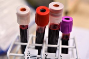 zdjęcie kolorowe: 4 szklane laboratoryjne fiolki z krwią ustawione w stojaku