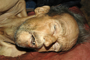 zdjęcie kolorowe: głowa zmarłego mężczyzny