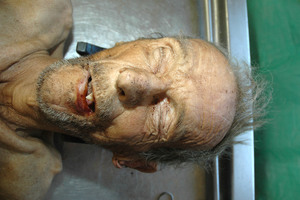 zdjęcie kolorowe: tors i głowa zmarłego mężczyzny widok z przodu